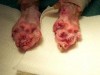bad_declaw_post-op_web.jpg