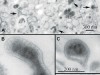 nanobacterii nanobacterii
