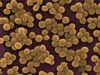 Staphylococcus aureus