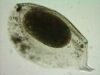 The Bosmina resting egg