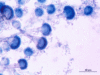 aspergillus11.gif