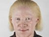 albinos african albinos african