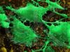 Cancer_cell, brain Cancer_cell, brain
