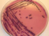 ecoli Epidemia de E. coli din Germania, provocata de castravetii din Spania