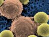 Un tratament revoluţionar cu celule modificate genetic a vindecat cancerul