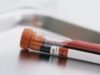 O analiza de sange va inlocui biopsiile pentru bolnavii de cancer